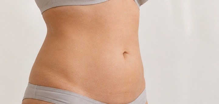SculptiCore Nachher – Bauch
